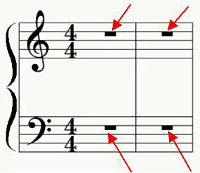 Thick line on a stave indicates a rest